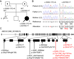 Novel compound heterozygous ABCA2 variants cause IDPOGSA, a variable phenotypic syndrome with intellectual disability