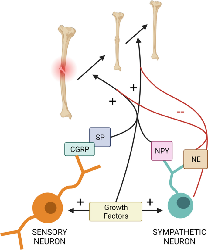 Cracking the Code: The Role of Peripheral Nervous System Signaling in Fracture Repair.