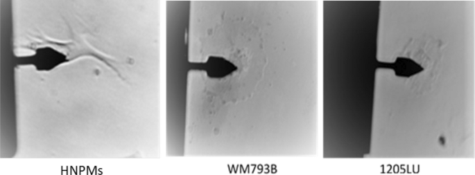 Microrheological comparison of melanoma cells by atomic force microscopy.