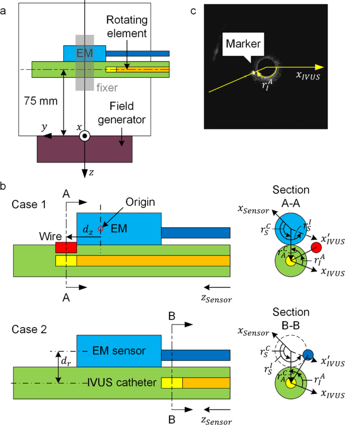 Design consideration on integration of mechanical intravascular ultrasound and electromagnetic tracking sensor for intravascular reconstruction.