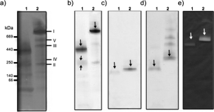 The branched mitochondrial respiratory chain from the jellyfish Stomolophus sp2 as a probable adaptive response to environmental changes.