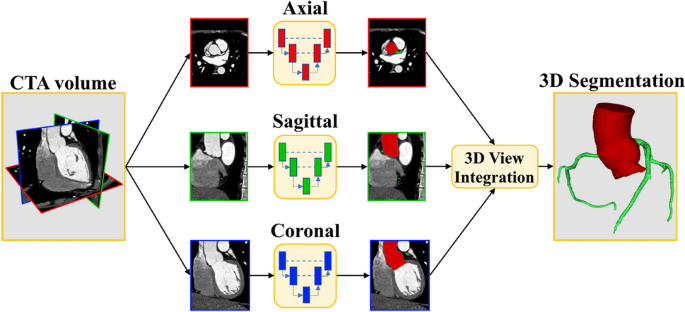 Automatic 3D Segmentation and Identification of Anomalous Aortic Origin of the Coronary Arteries Combining Multi-view 2D Convolutional Neural Networks