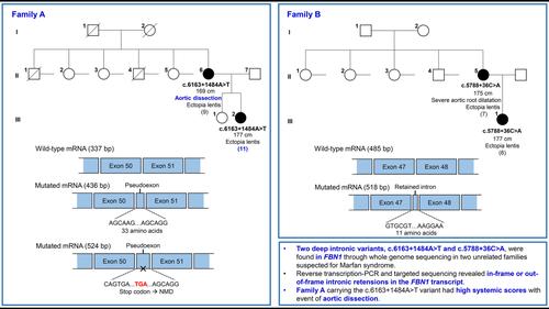 Overcoming challenges associated with identifying FBN1 deep intronic variants through whole-genome sequencing