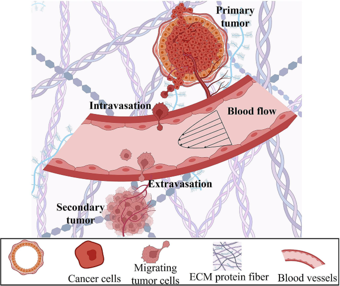 The impact of tumor microenvironment: unraveling the role of physical cues in breast cancer progression.