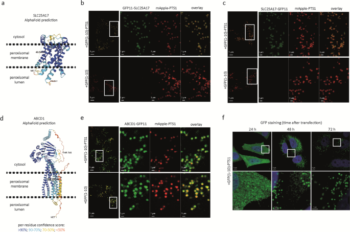 Studying the topology of peroxisomal acyl-CoA synthetases using self-assembling split sfGFP.