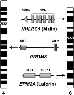 Lafora progressive myoclonus epilepsy: Disease mechanism and therapeutic attempts