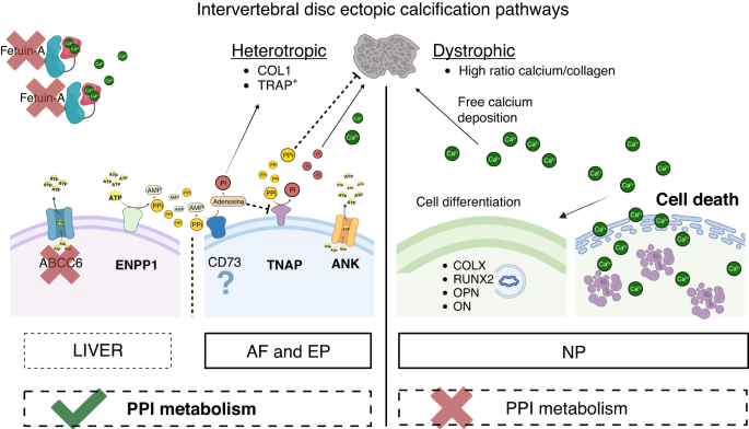 A new perspective on intervertebral disc calcification—from bench to bedside