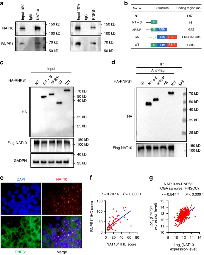 RNPS1 stabilizes NAT10 protein to facilitate translation in cancer via tRNA ac4C modification