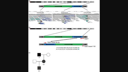 Identification of a complex intrachromosomal inverted insertion in the long arm of chromosome 9 as a cause of tuberous sclerosis complex in a Korean family.