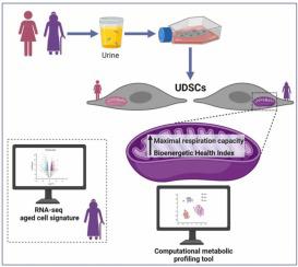 Age-dependent energy metabolism and transcriptome changes in urine-derived stem cells