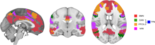 Time-varying functional connectivity predicts fluctuations in sustained attention in a serial tapping task.