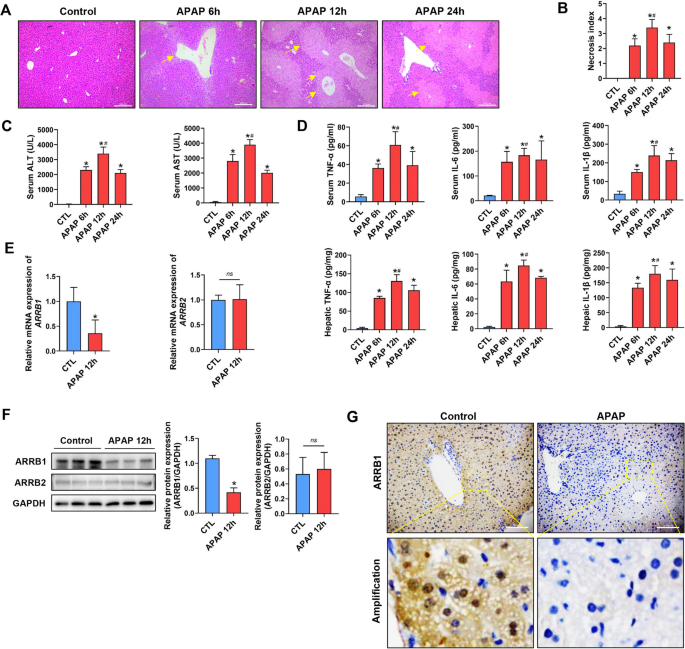 ARRB1 downregulates acetaminophen-induced hepatoxicity through binding to p-eIF2α to inhibit ER stress signaling.