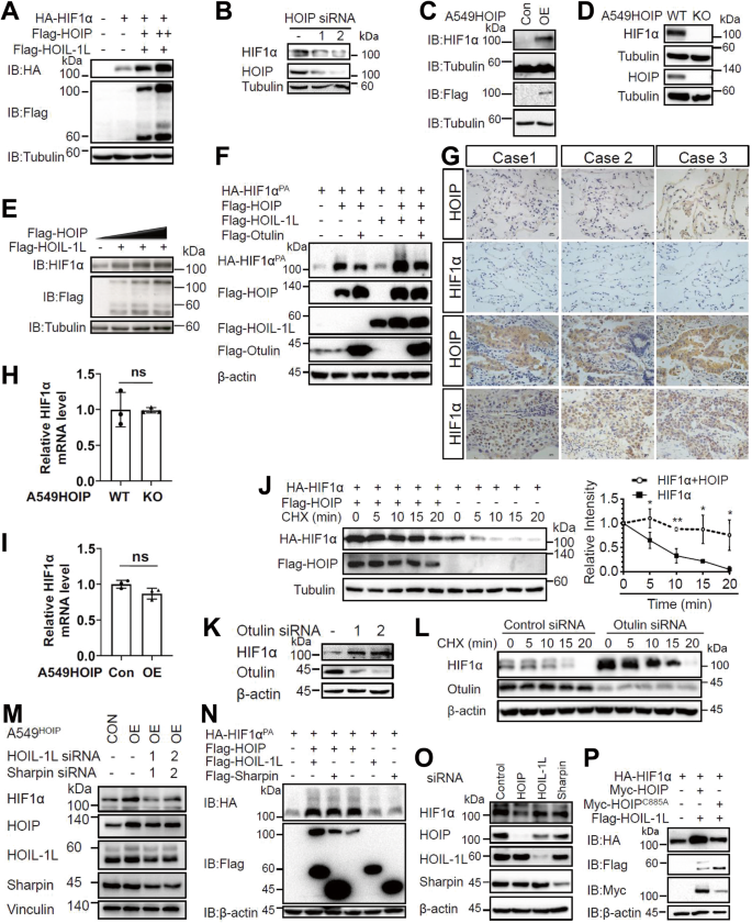 LUBAC promotes angiogenesis and lung tumorigenesis by ubiquitinating and antagonizing autophagic degradation of HIF1α