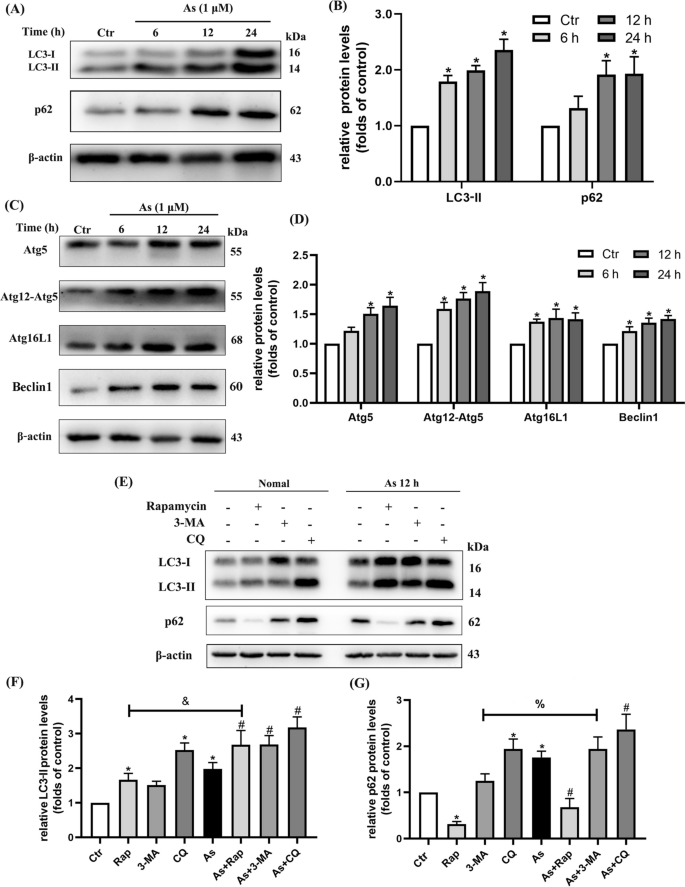 TFEB and TFE3 cooperate in regulating inorganic arsenic-induced autophagy-lysosome impairment and immuno-dysfunction in primary dendritic cells.