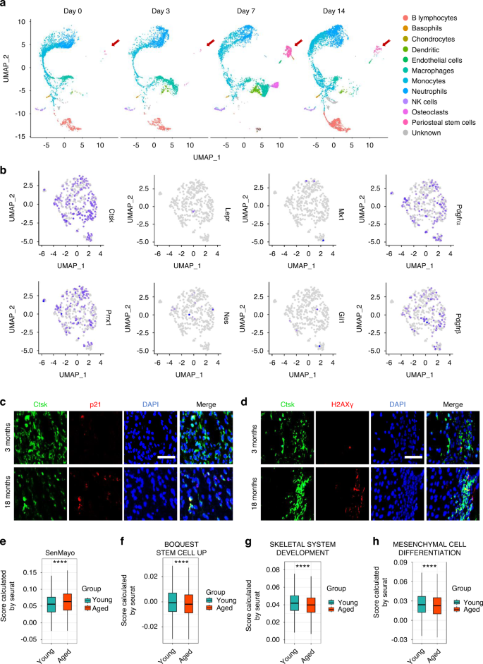 Age-related secretion of grancalcin by macrophages induces skeletal stem/progenitor cell senescence during fracture healing.