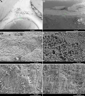 Microstructure and mineralogy of the tube and operculum of serpulid polychaetes from temperate and warm waters