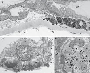 Fine Structure of the Gametes in Rhynchospio glandulosa (Annelida: Spionidae), a Hermaphrodite Brooding Larvae on the Parent’s Dorsum