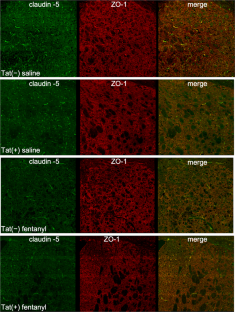 Fentanyl dysregulates neuroinflammation and disrupts blood-brain barrier integrity in HIV-1 Tat transgenic mice.