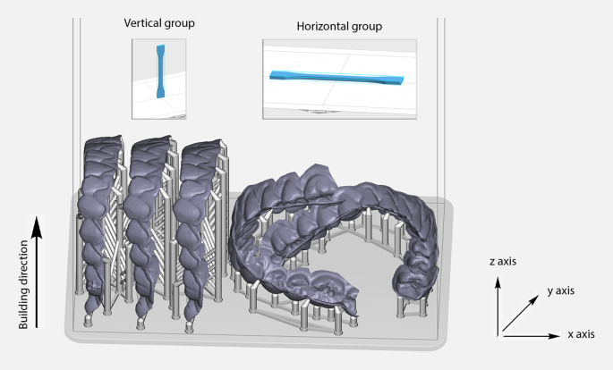 Effect of printing orientation on mechanical properties of 3D-printed orthodontic aligners.