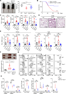 Disulfiram ameliorates STING/MITA-dependent inflammation and autoimmunity by targeting RNF115