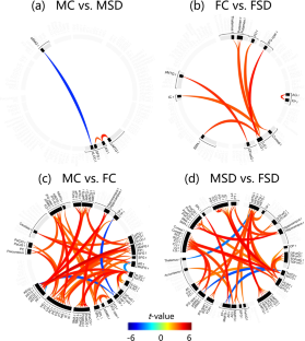 Effects of sleep deprivation on language-related brain functional connectivity: differences by gender and age.