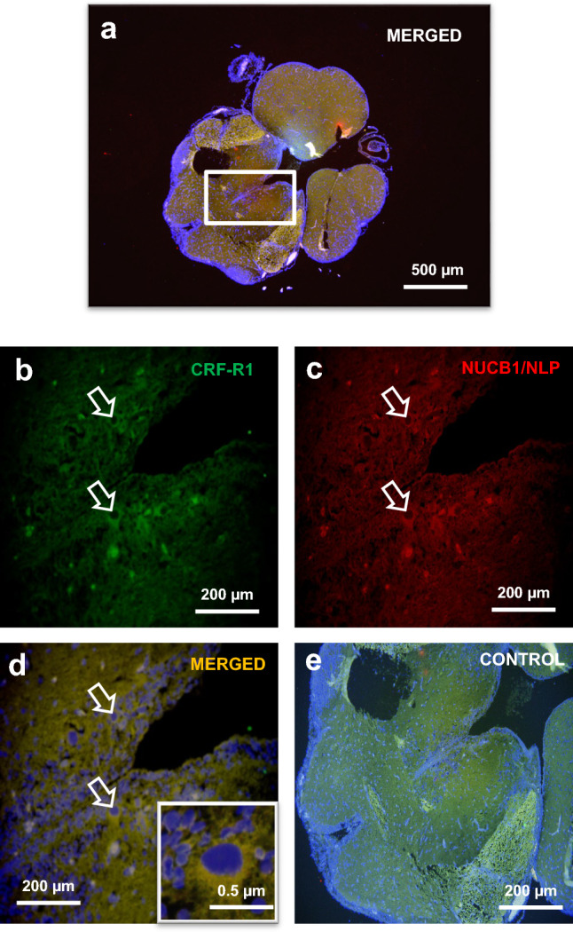 Stress induces nucleobindin-1 mRNA and nesfatin-1-like peptide stimulates cortisol secretion in goldfish.