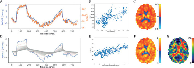 Cerebrovascular Reactivity Following Spinal Cord Injury.