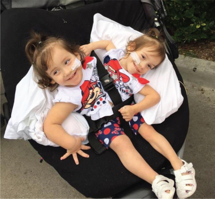 Rehabilitation and functional outcomes for thoraco-omphalo-ischiopagus conjoined twins five years after separation: A case report.
