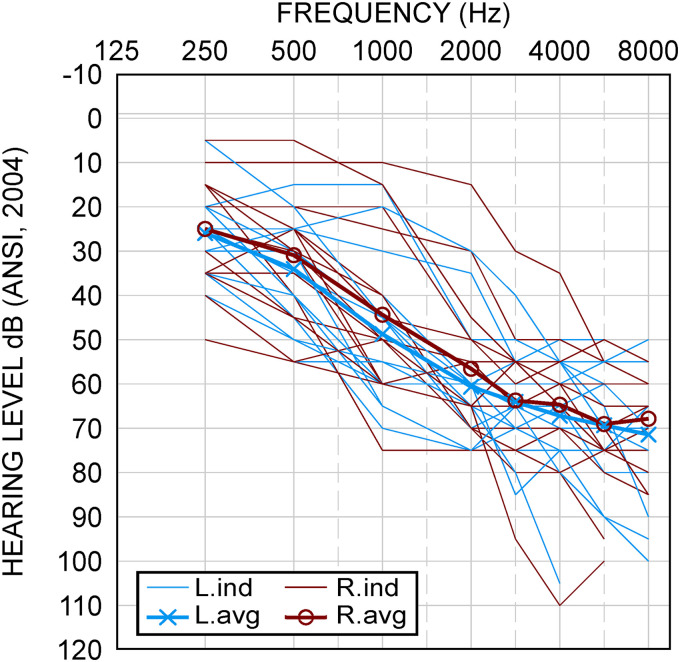 Alpha-Band Dynamics of Hearing Aid Wearers Performing the Repeat-Recall Test (RRT).