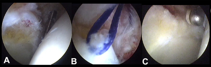How to start with hip arthroscopy in a safe and effective manner, using an evidence-based approach.