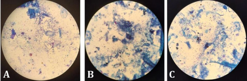 Active surveillance and associated epidemiological risk factors of caprine paratuberculosis in selected district of Odisha, India.