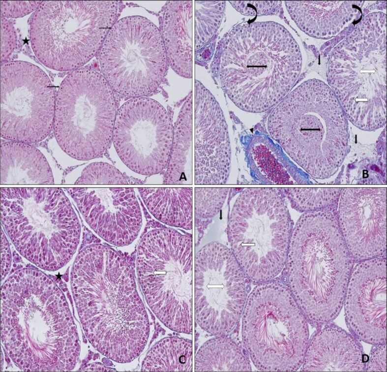 Effects of quercetin on gentamicin-induced experimental testicular injury in rats.