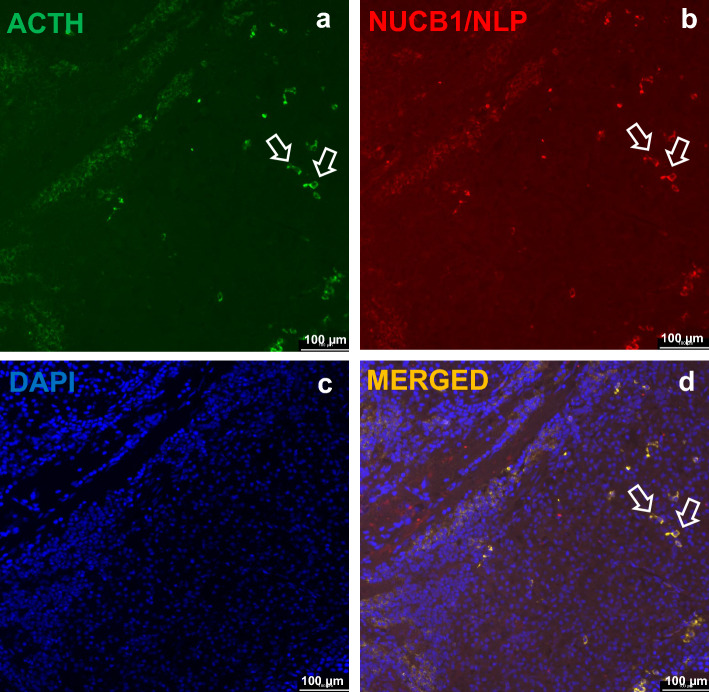 Stress induces nucleobindin-1 mRNA and nesfatin-1-like peptide stimulates cortisol secretion in goldfish.