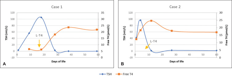 Different Forms of Hypothyroidism in Infants with Maternal Graves' Disease: A Case Series.