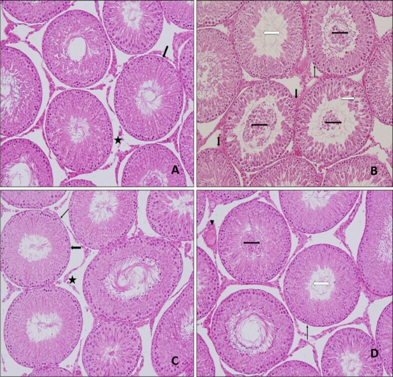 Effects of quercetin on gentamicin-induced experimental testicular injury in rats.