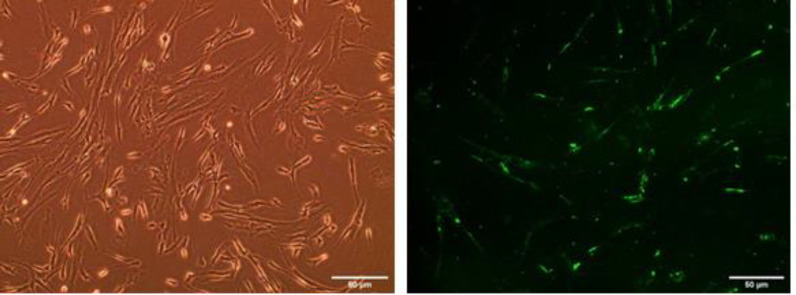 Down-regulation of key regulatory factors in sphingosine-1-phosphate (S1P) pathway in human lung fibroblasts transfected with selected microRNAs.