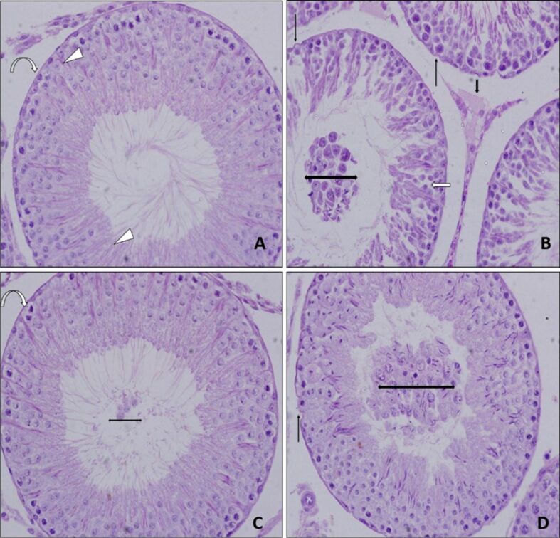 Effects of quercetin on gentamicin-induced experimental testicular injury in rats.