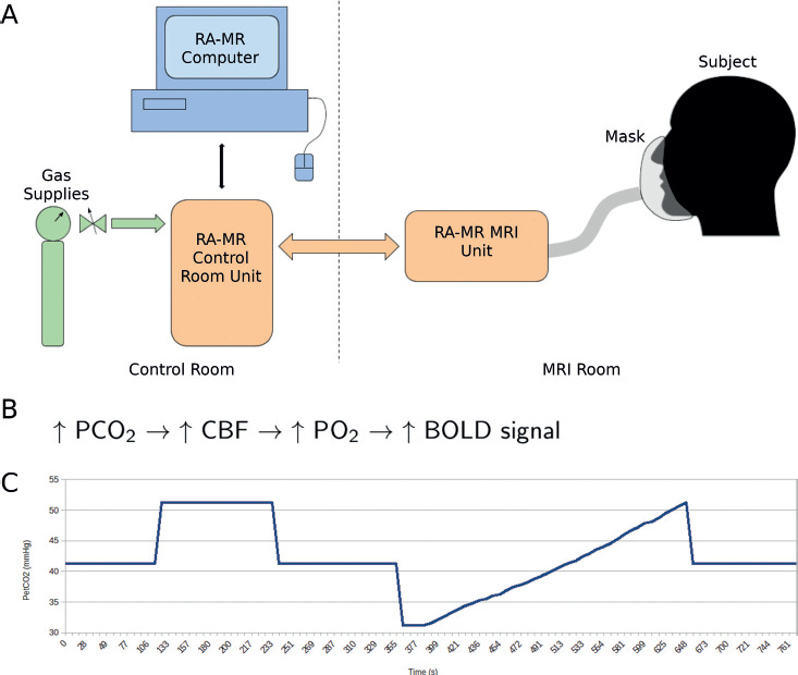 Cerebrovascular Reactivity Following Spinal Cord Injury.