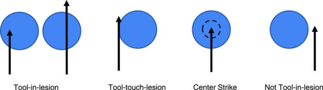 "Tool-in-lesion" Accuracy of Galaxy System-A Robotic Electromagnetic Navigation BroncHoscopy With Integrated Tool-in-lesion-Tomosynthesis Technology: The MATCH Study.