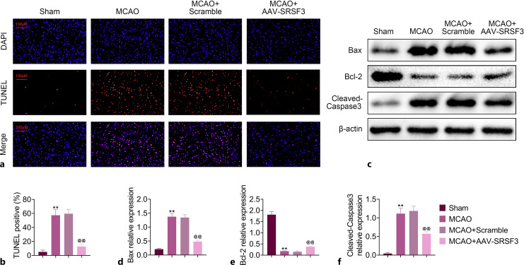 SRSF3 Alleviates Ischemic Cerebral Infarction Damage by Activating the PI3K/AKT Pathway.