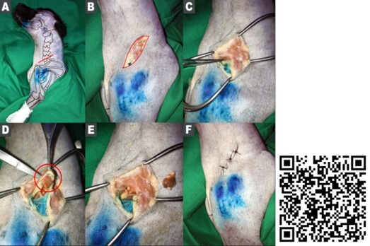 Illustrated technique of superficial lymphadenectomy of dogs and cats: preliminary study.