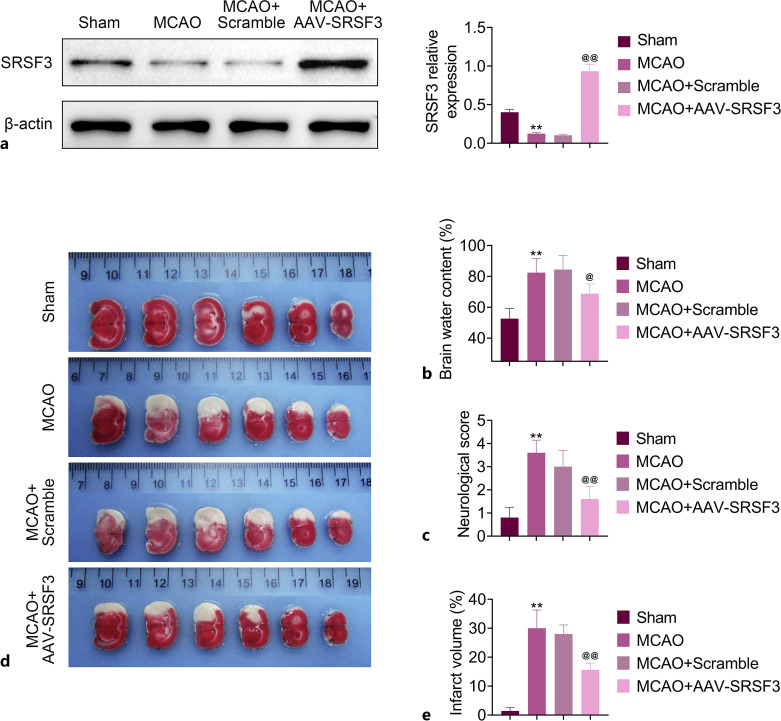 SRSF3 Alleviates Ischemic Cerebral Infarction Damage by Activating the PI3K/AKT Pathway.