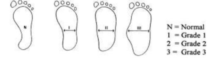 Effect of Medial Longitudinal Arch Height of the Foot on Static and Dynamic Balance in 7-10-Year-Old Boy Gymnasts.