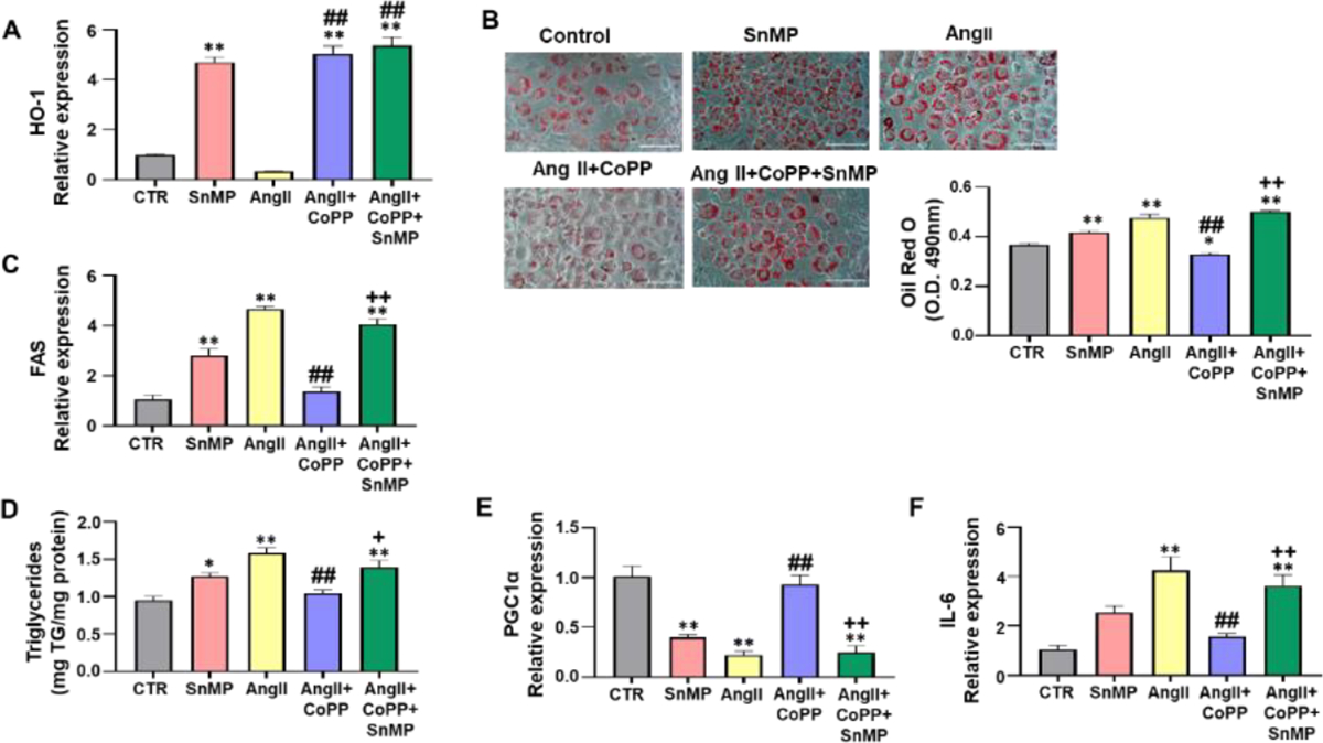 Dysregulation of HO-1-SIRT1 Axis is Associated with AngII-Induced Adipocyte Dysfunction.
