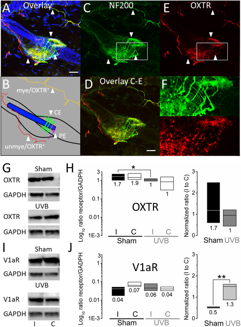 Effects of systemic oxytocin administration on ultraviolet B-induced nociceptive hypersensitivity and tactile hyposensitivity in mice.