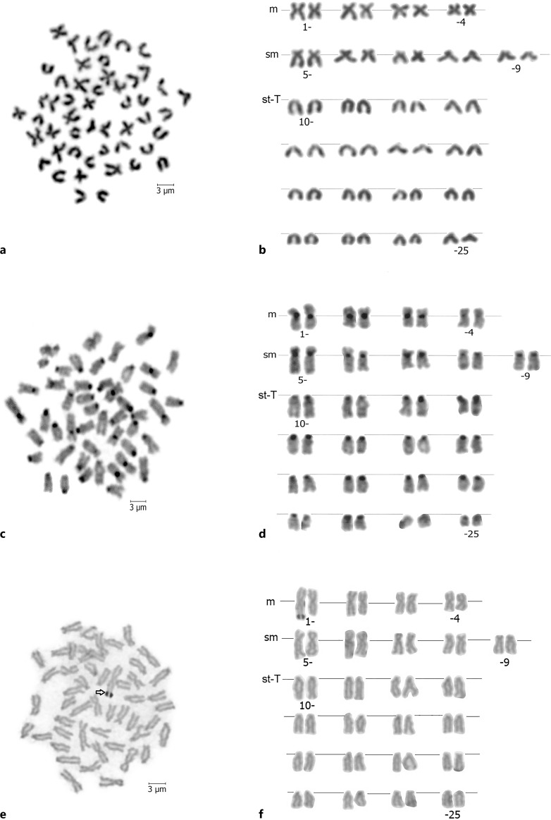 A Detailed Karyological Investigation of three Endemic Cobitis Linnaeus, 1758 Species (Teleostei, Cobitidae) in Anatolia, Türkiye.