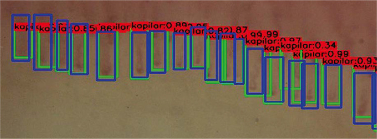 Automatic assessment of nailfold capillaroscopy software: a pilot study.