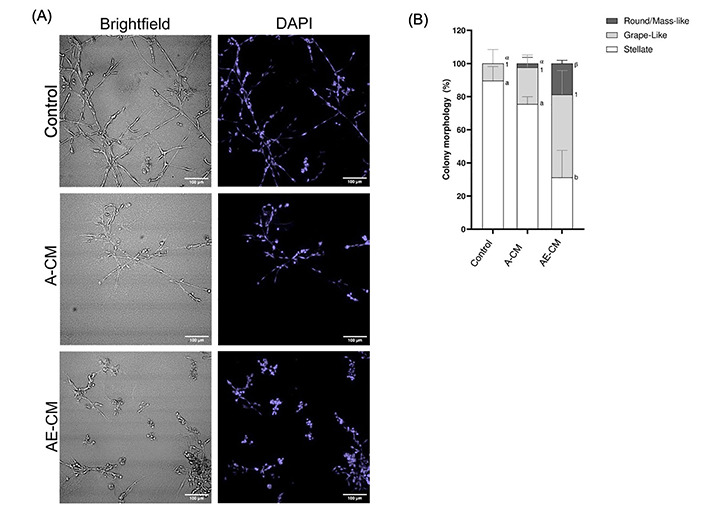 Identification of lysyl oxidase as an adipocyte-secreted mediator that promotes a partial mesenchymal-to-epithelial transition in MDA-MB-231 cells.