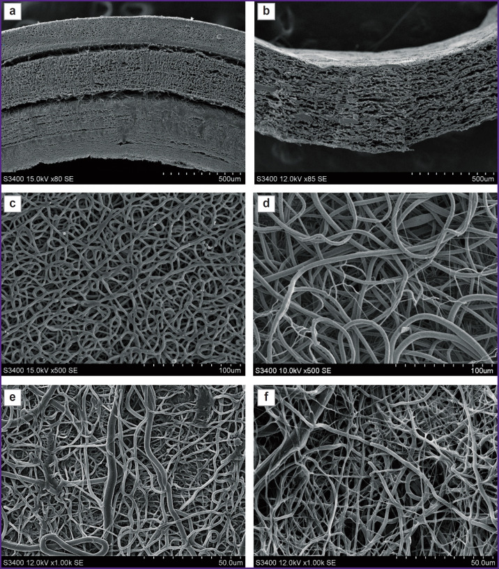 Composite Tissue-Engineered Small-Diameter Vascular Grafts Based on Polycaprolactone and Polyurethane with Growth Factors and Atrombogenic Drug Coatings: Surface Ultrastructure, Physical and Mechanical Properties.