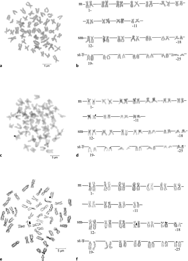 A Detailed Karyological Investigation of three Endemic Cobitis Linnaeus, 1758 Species (Teleostei, Cobitidae) in Anatolia, Türkiye.